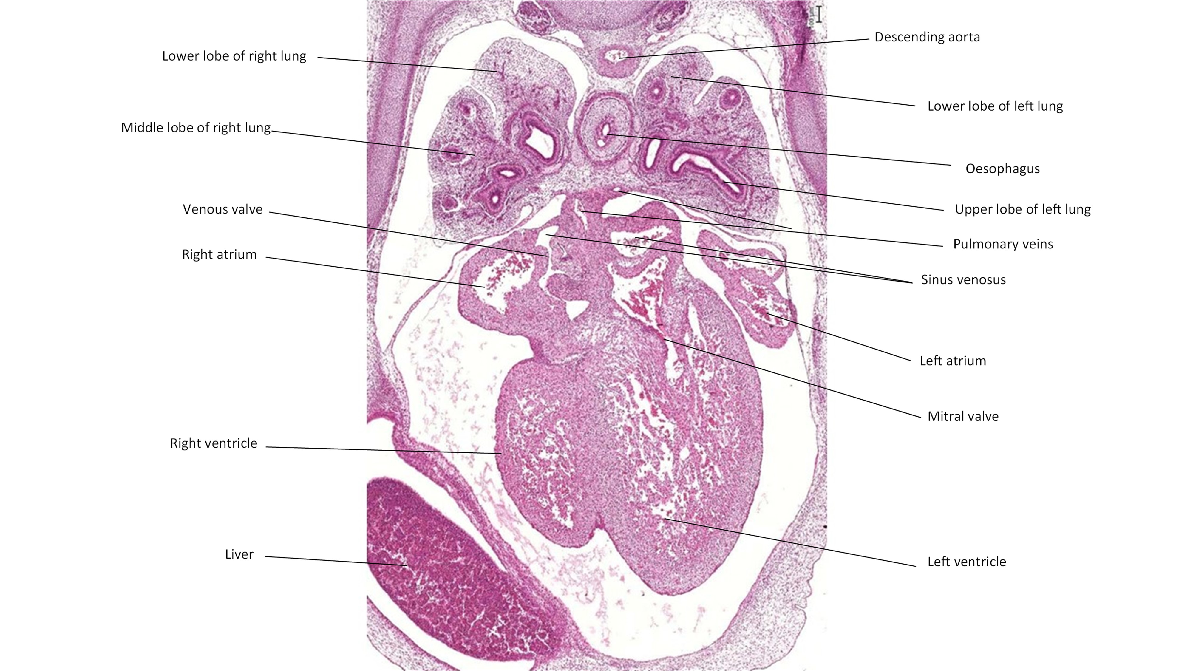 A histology section of a human embryo