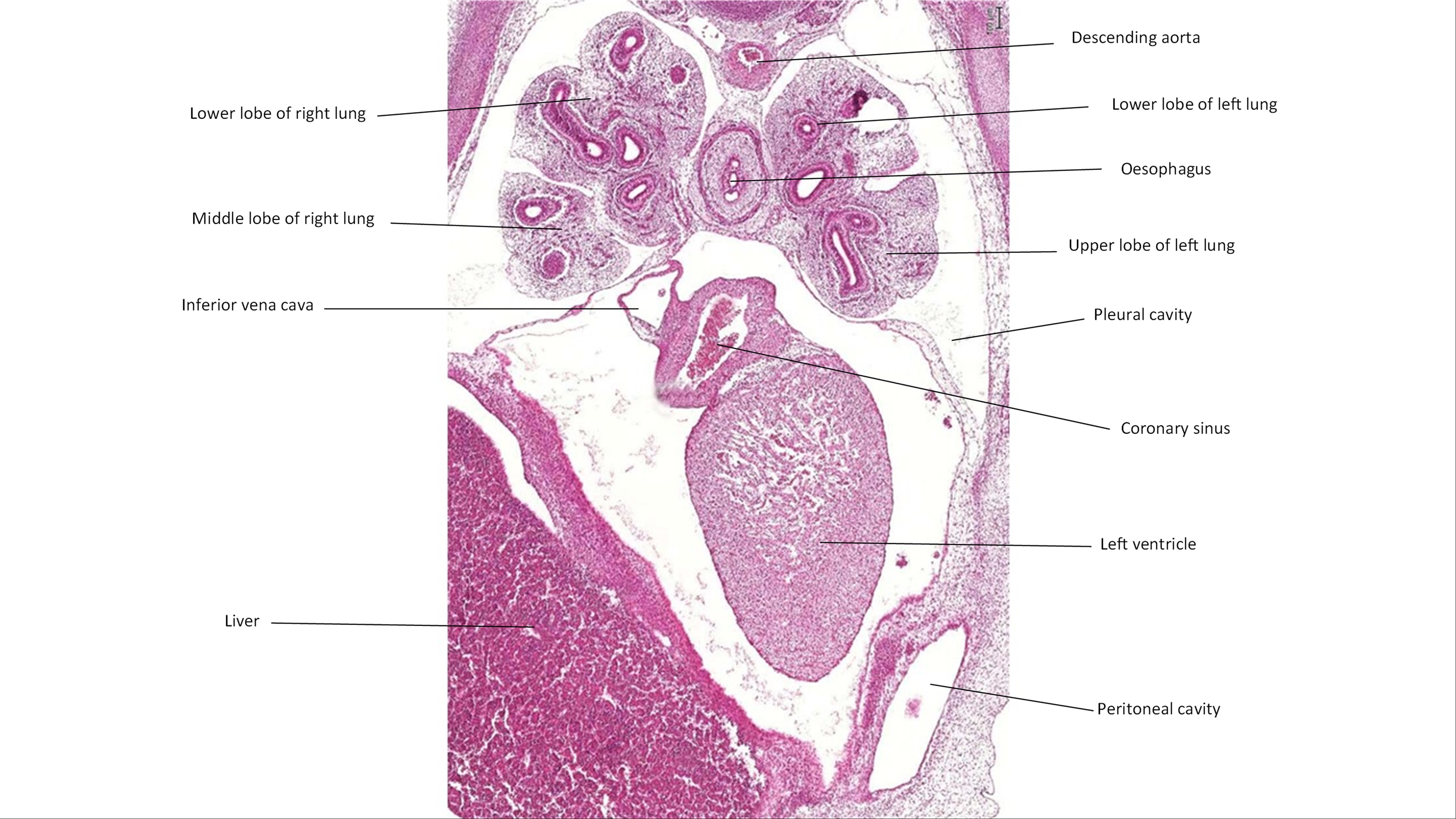 A histology section of a human embryo