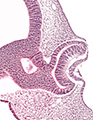 A human embryonic eye
