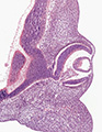 A human embryonic eye