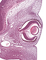 A human embryonic eye
