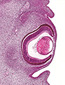 A human embryonic eye