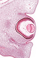 A human embryonic eye