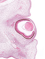 A human embryonic eye