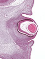 A human embryonic eye