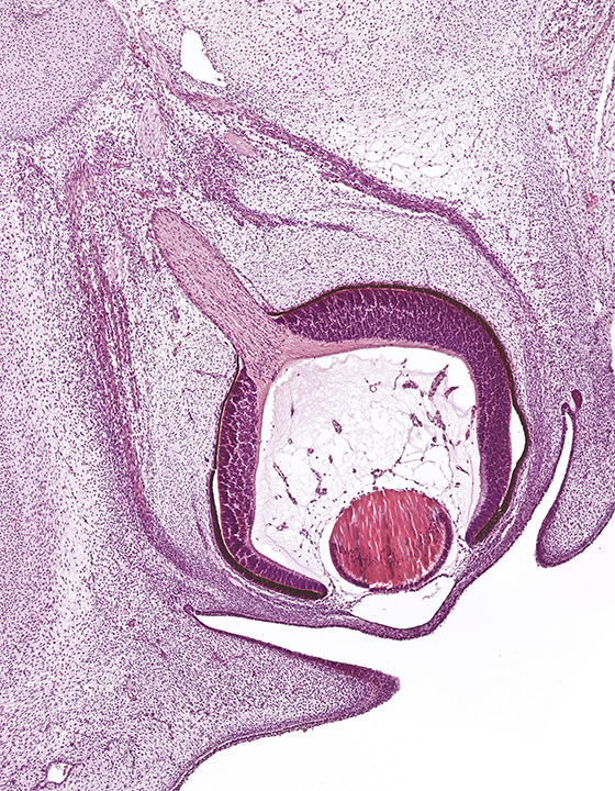 A human embryonic eye
