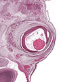 A human embryonic eye
