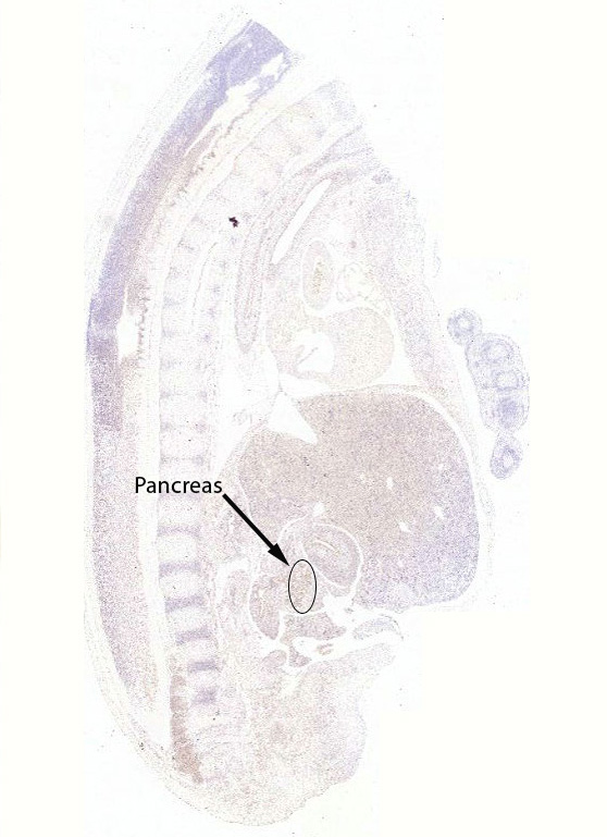 Gene expression in the human fetal pancreas