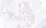 Gene expression in the human fetal pancreas