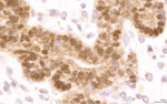 Gene expression in the human fetal pancreas