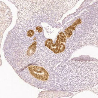 Human fetal pancreas gene expression