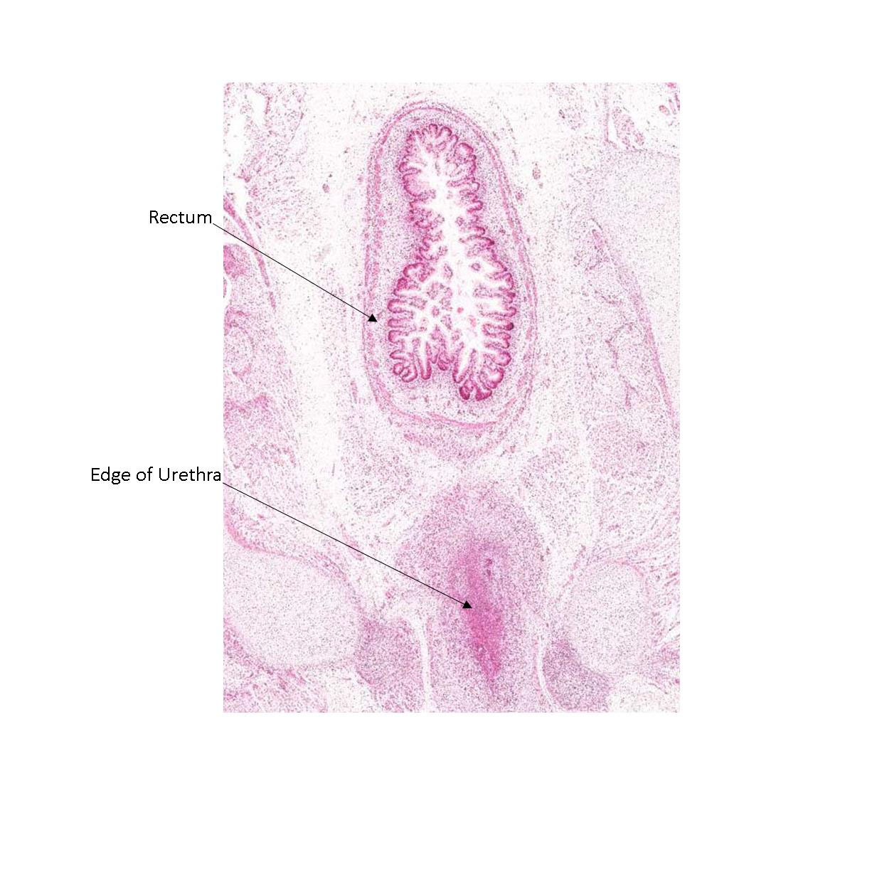 A histology section of a human fetus