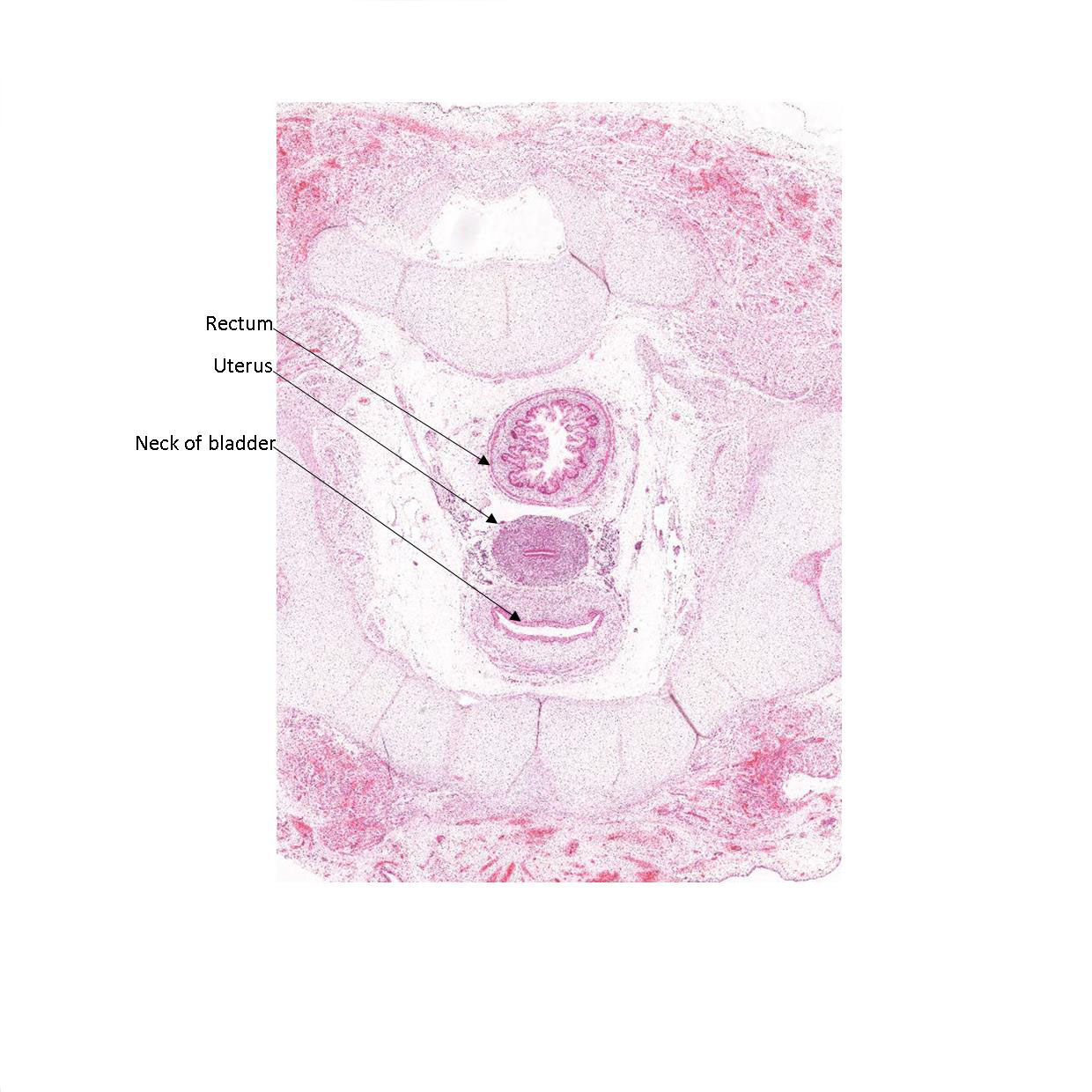 A histology section of a human fetus