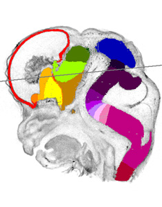gene expression in the human embryonic brain