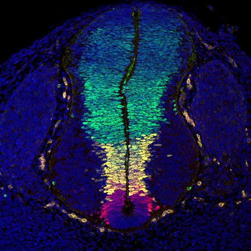 Gene expression in the human embryonic spinal cord