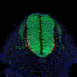 Gene expression in the human embryonic spinal cord