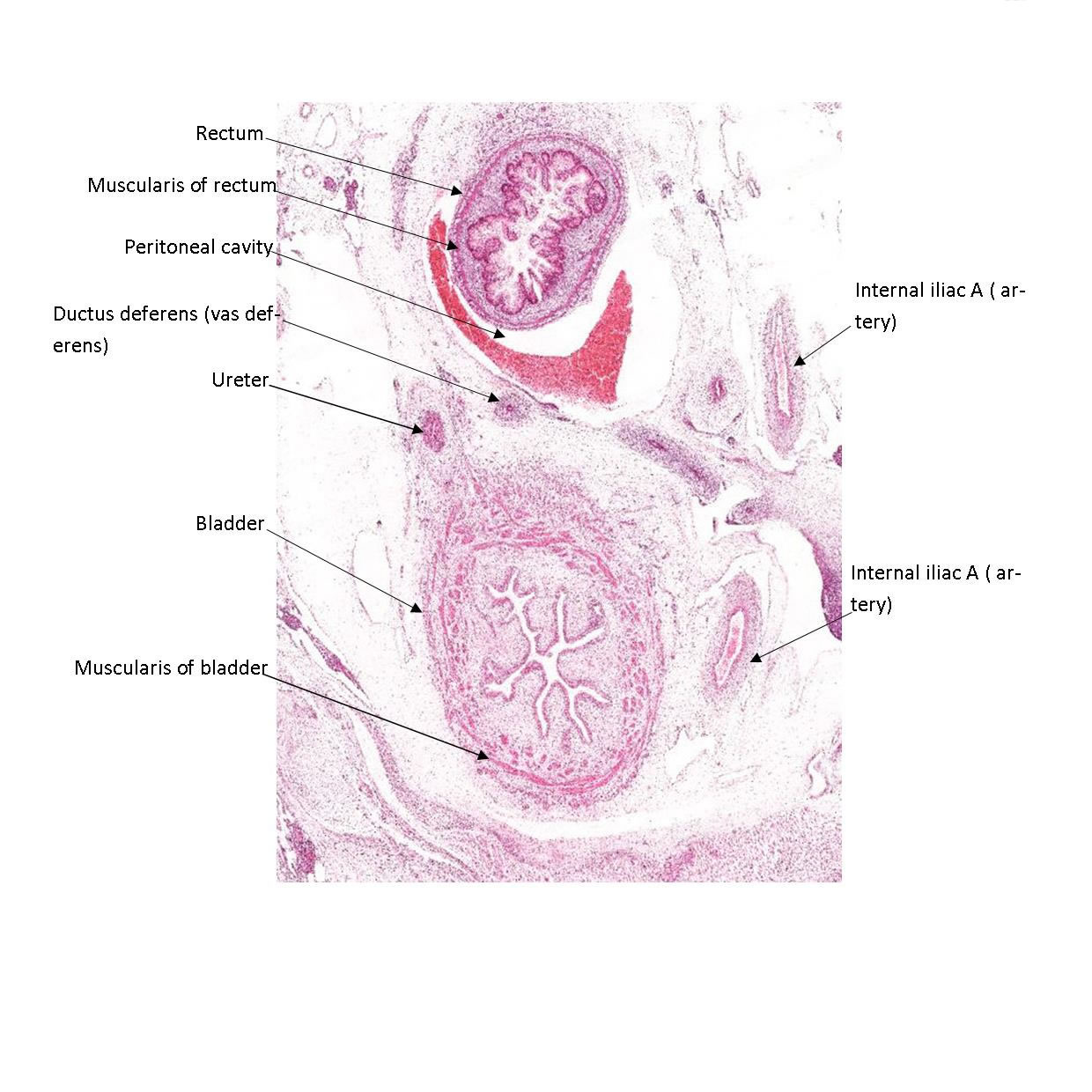 A histology section of a human fetus