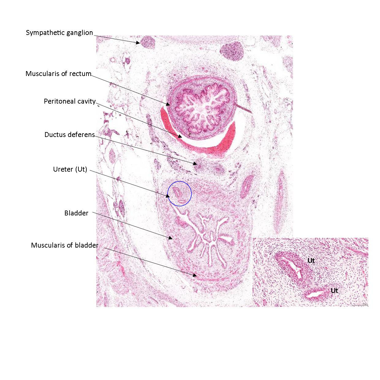 A histology section of a human fetus