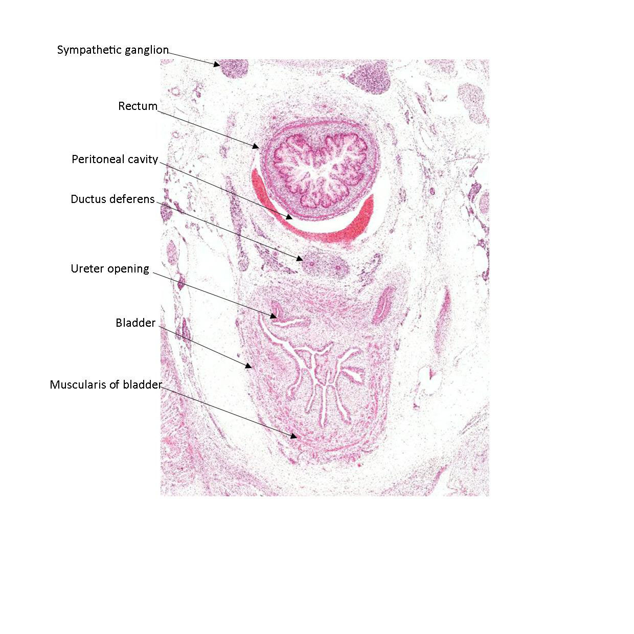 A histology section of a human fetus