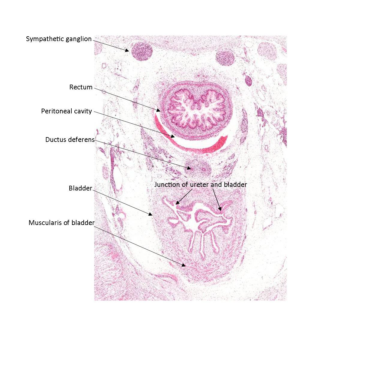 A histology section of a human fetus