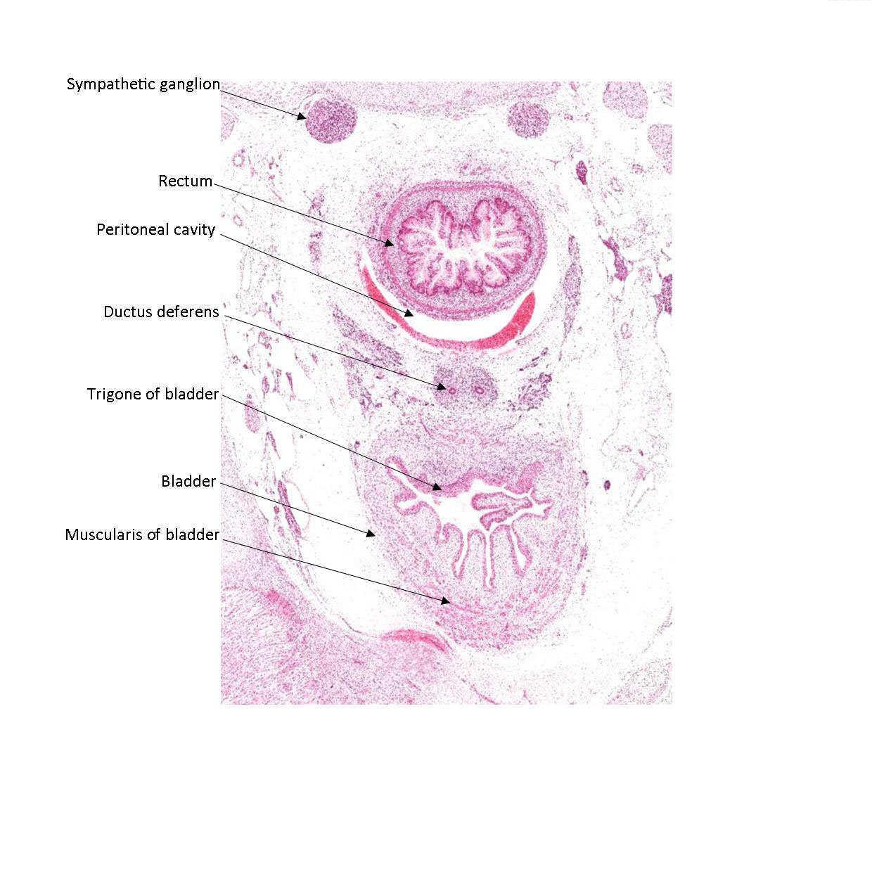 A histology section of a human fetus