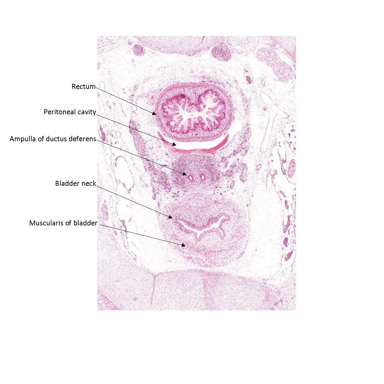 A histology section of a human fetus