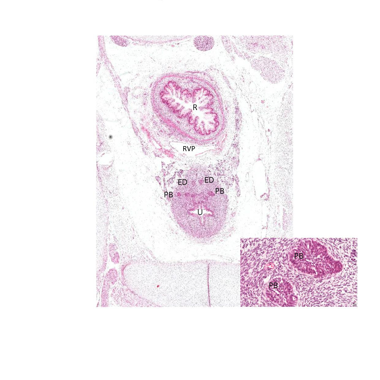 A histology section of a human fetus