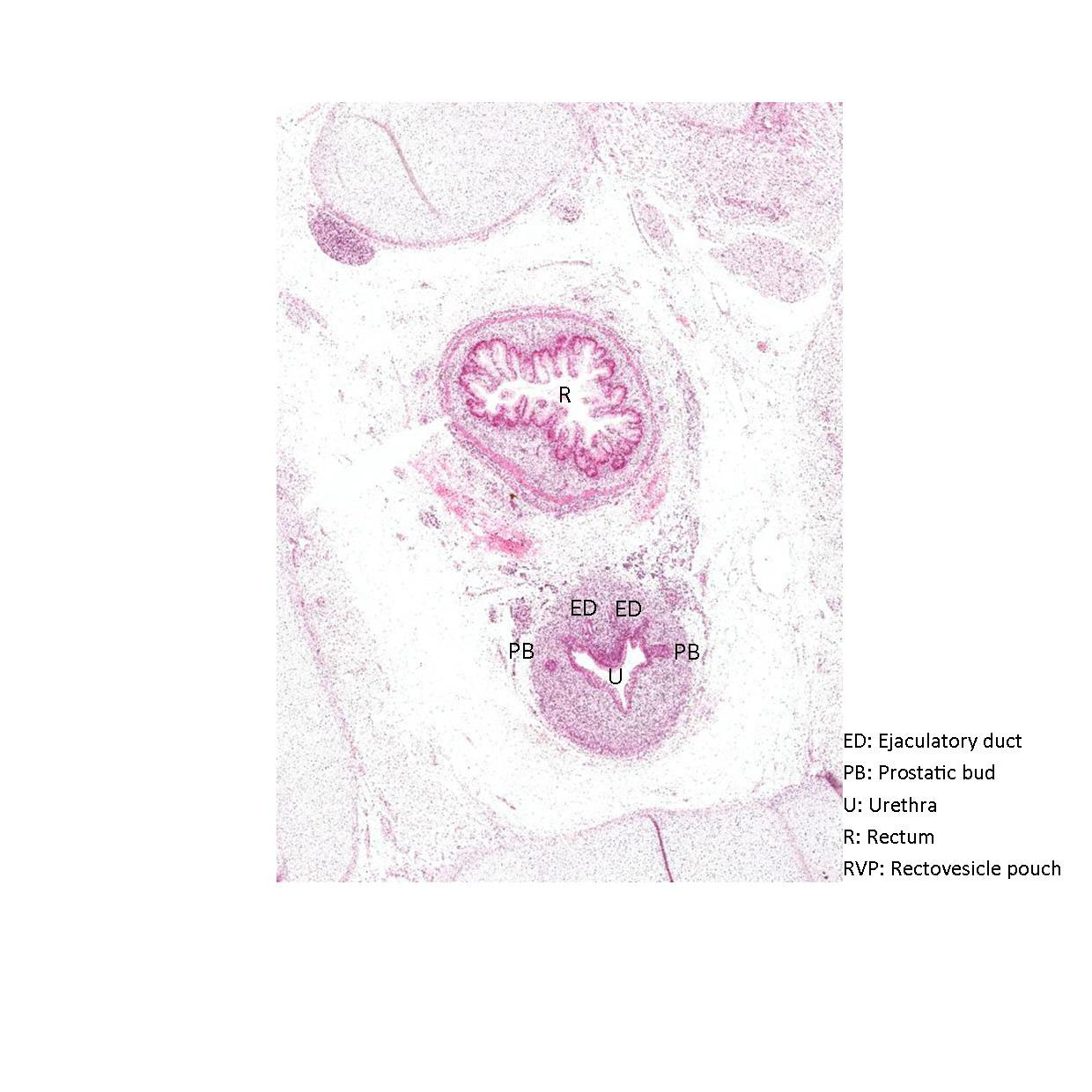 A histology section of a human fetus