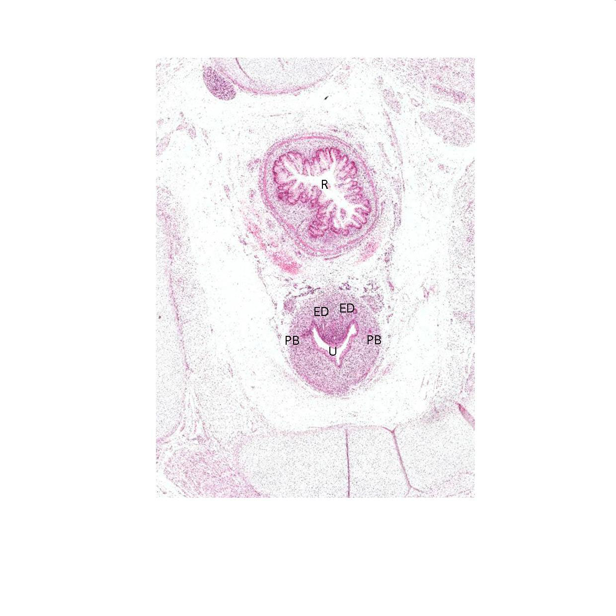 A histology section of a human fetus