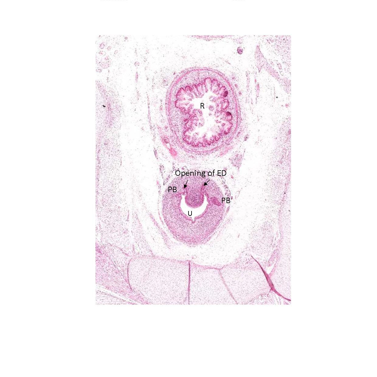 A histology section of a human fetus