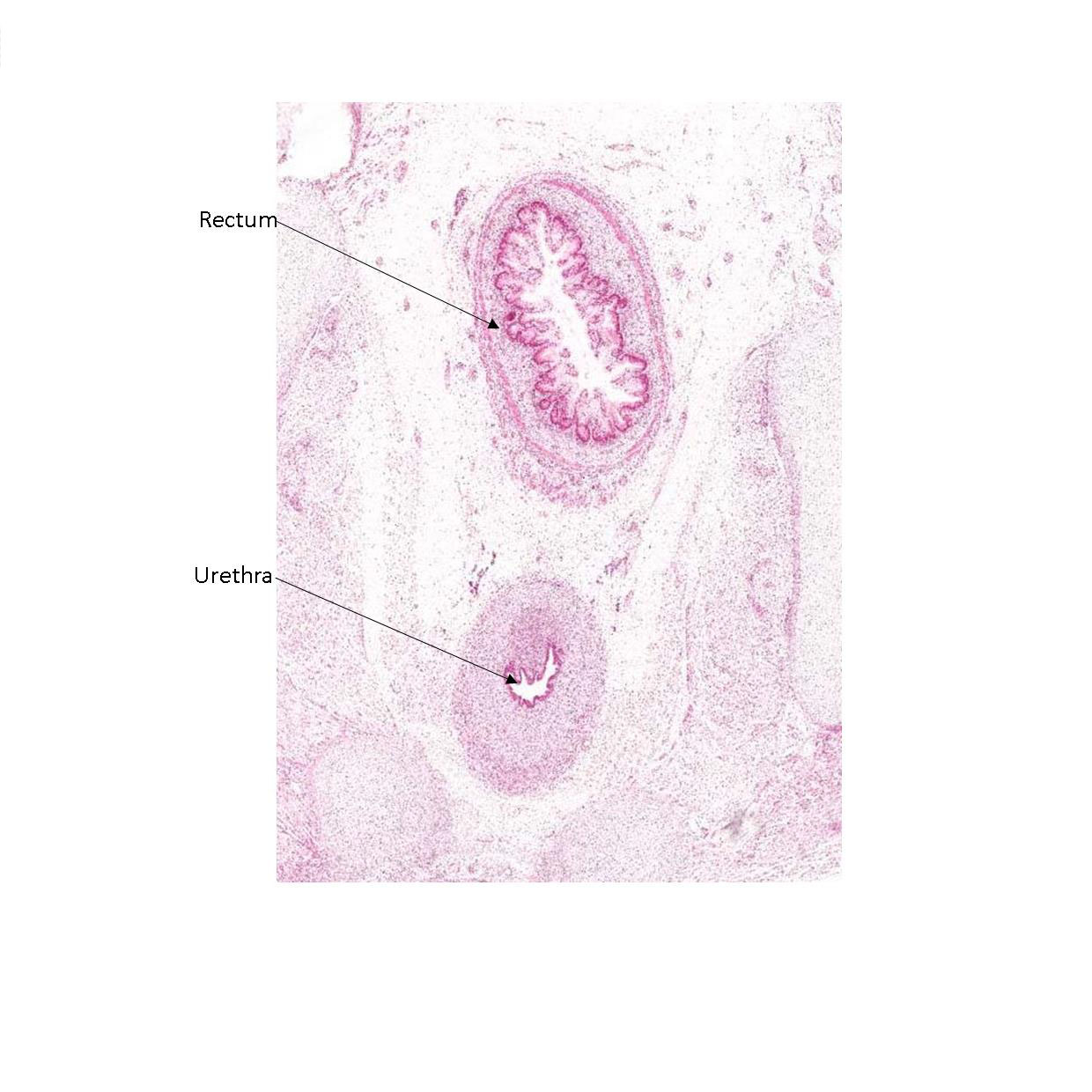 A histology section of a human fetus