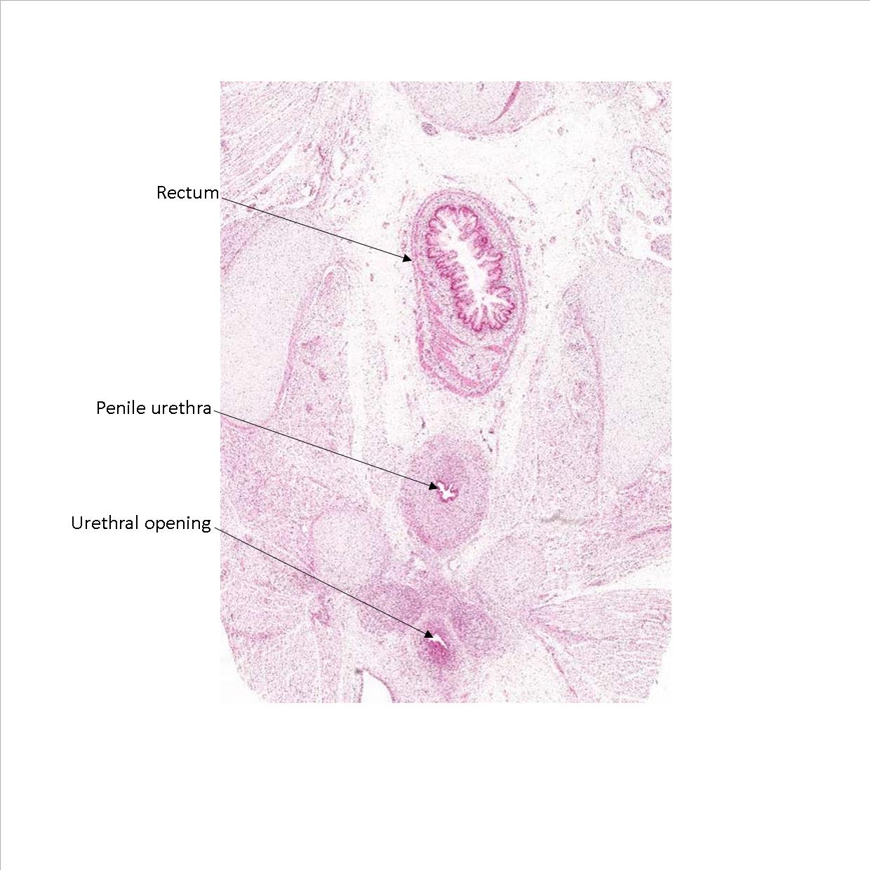 A histology section of a human fetus