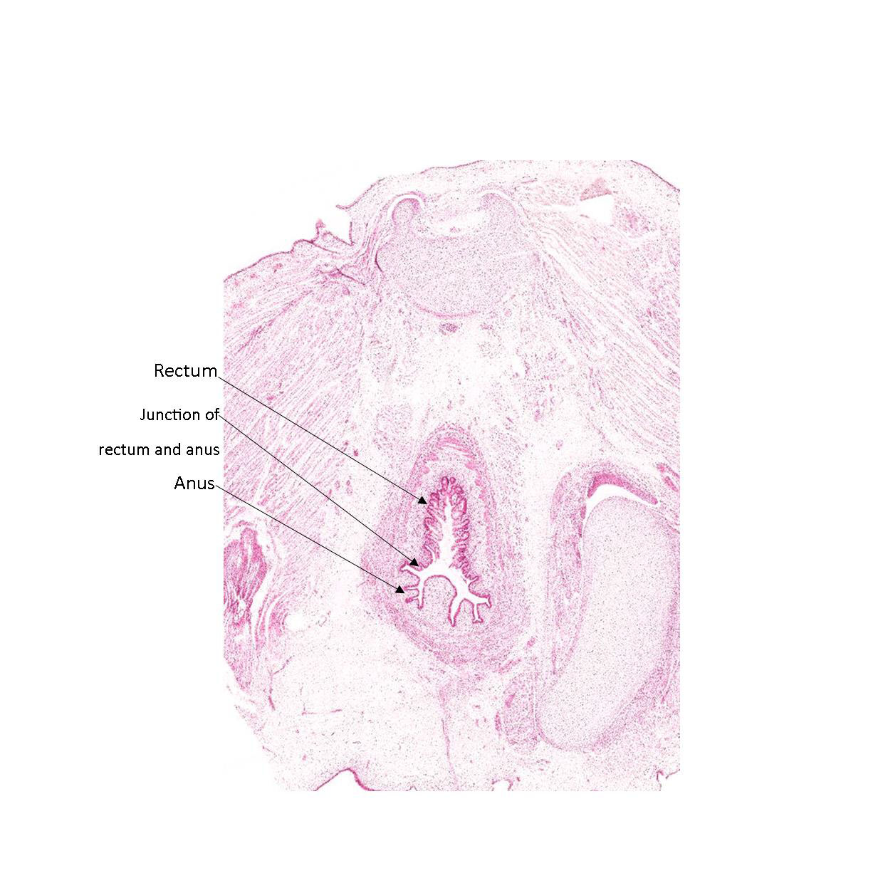 A histology section of a human fetus