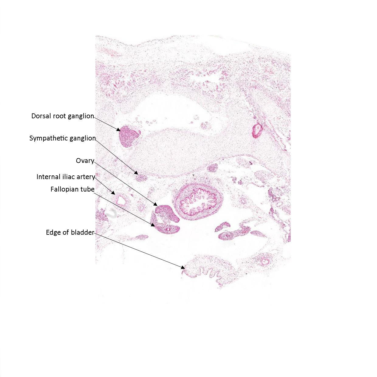 A histology section of a human fetus