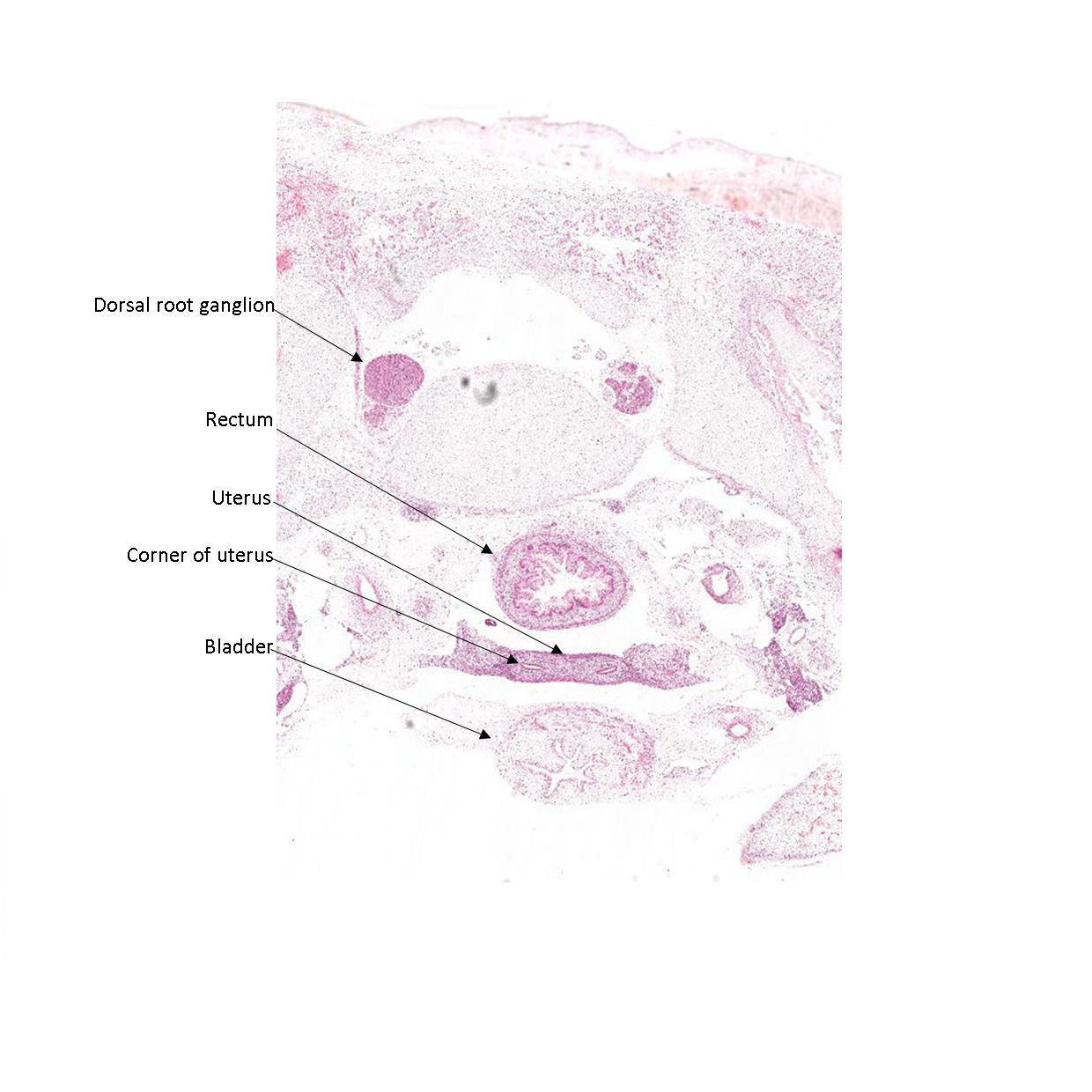 A histology section of a human fetus