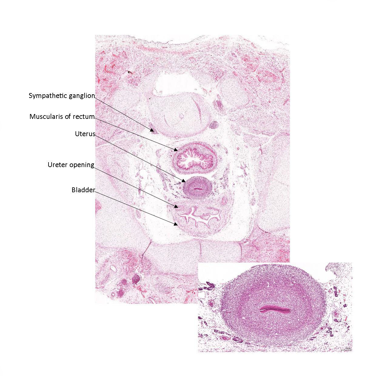 A histology section of a human fetus