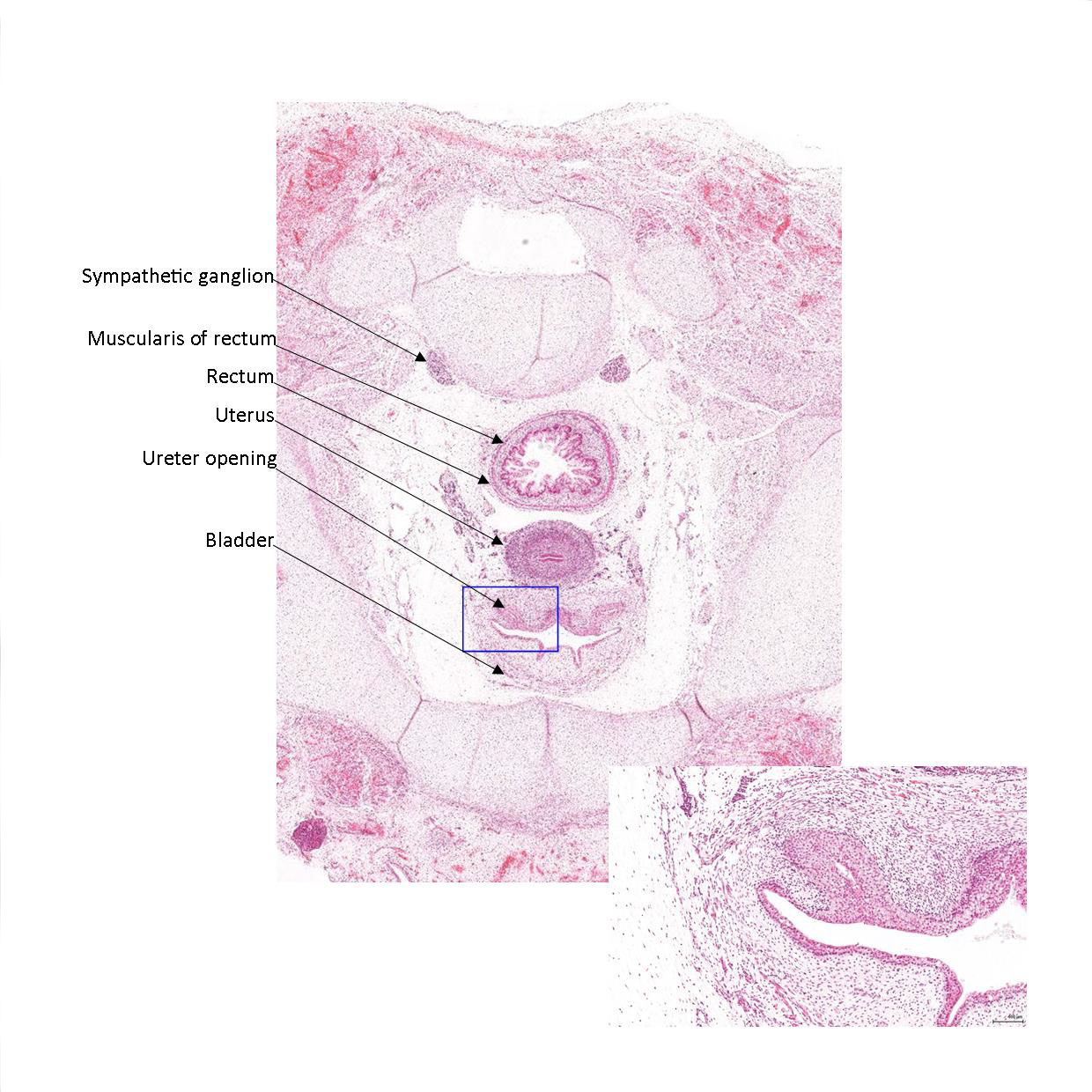 A histology section of a human fetus