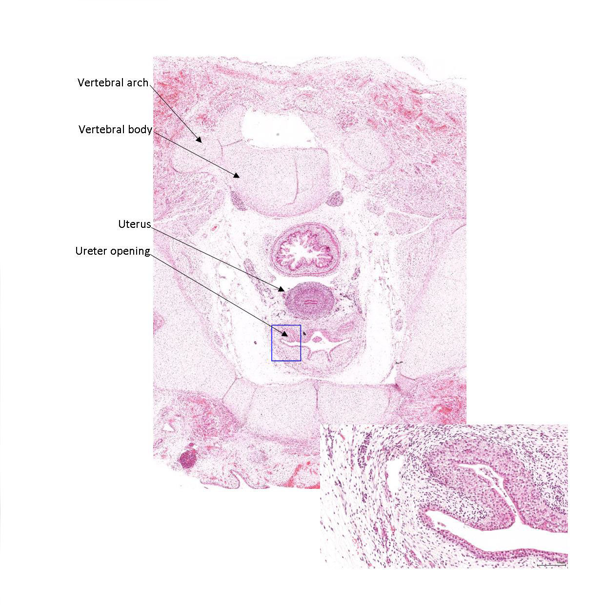 A histology section of a human fetus