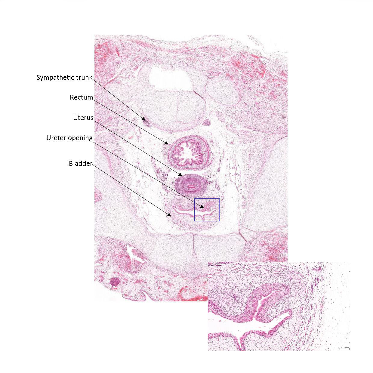 A histology section of a human fetus