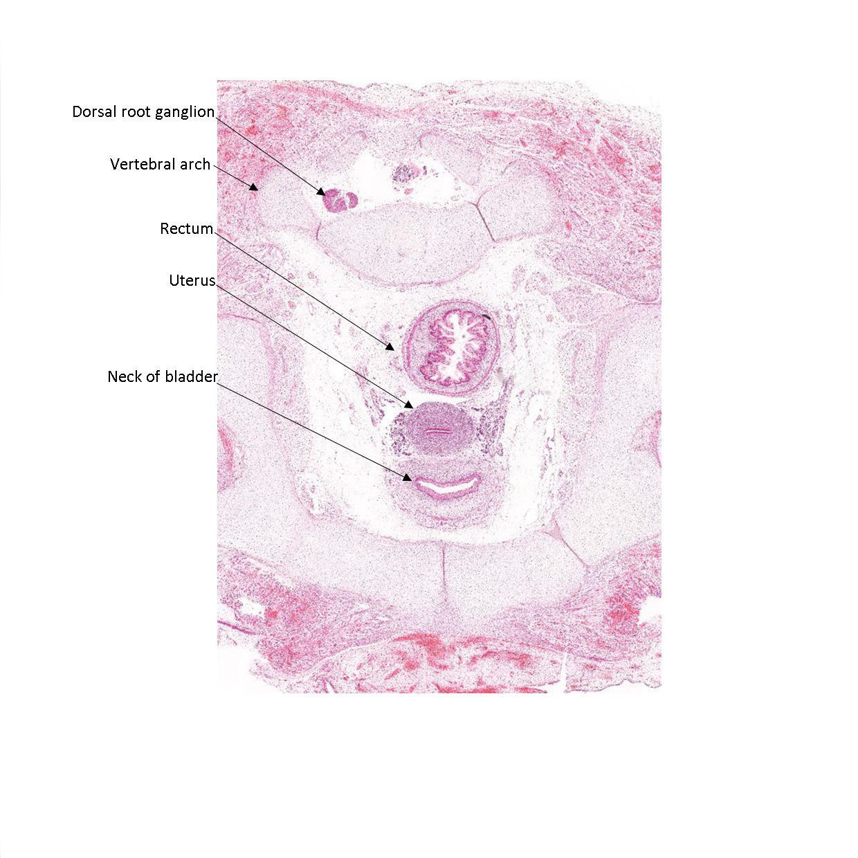 A histology section of a human fetus