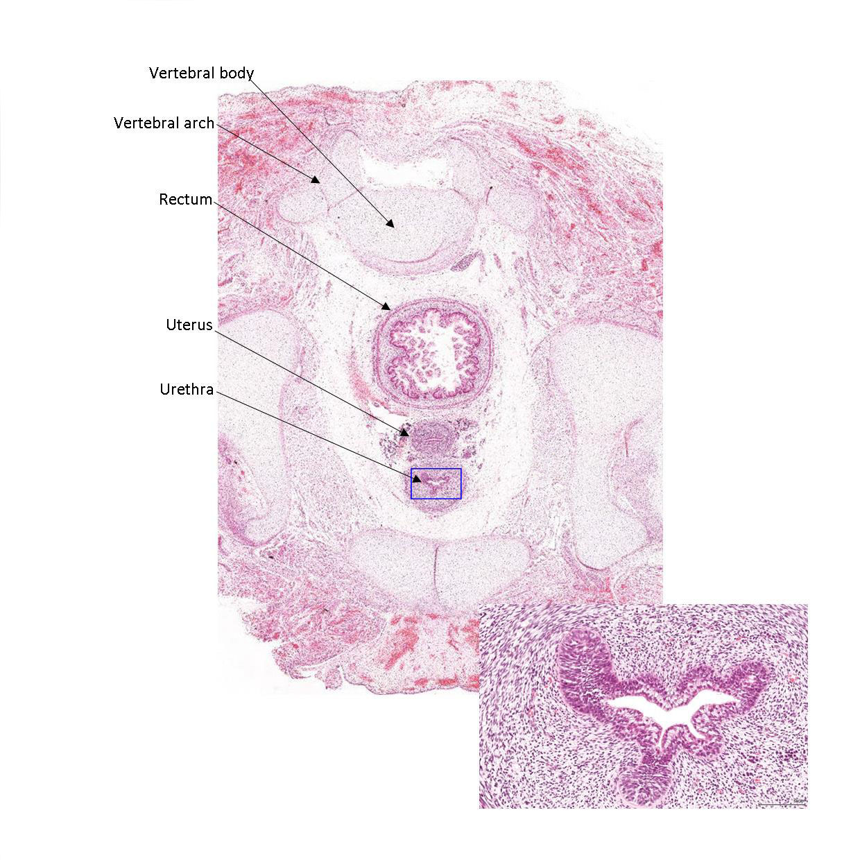 A histology section of a human fetus