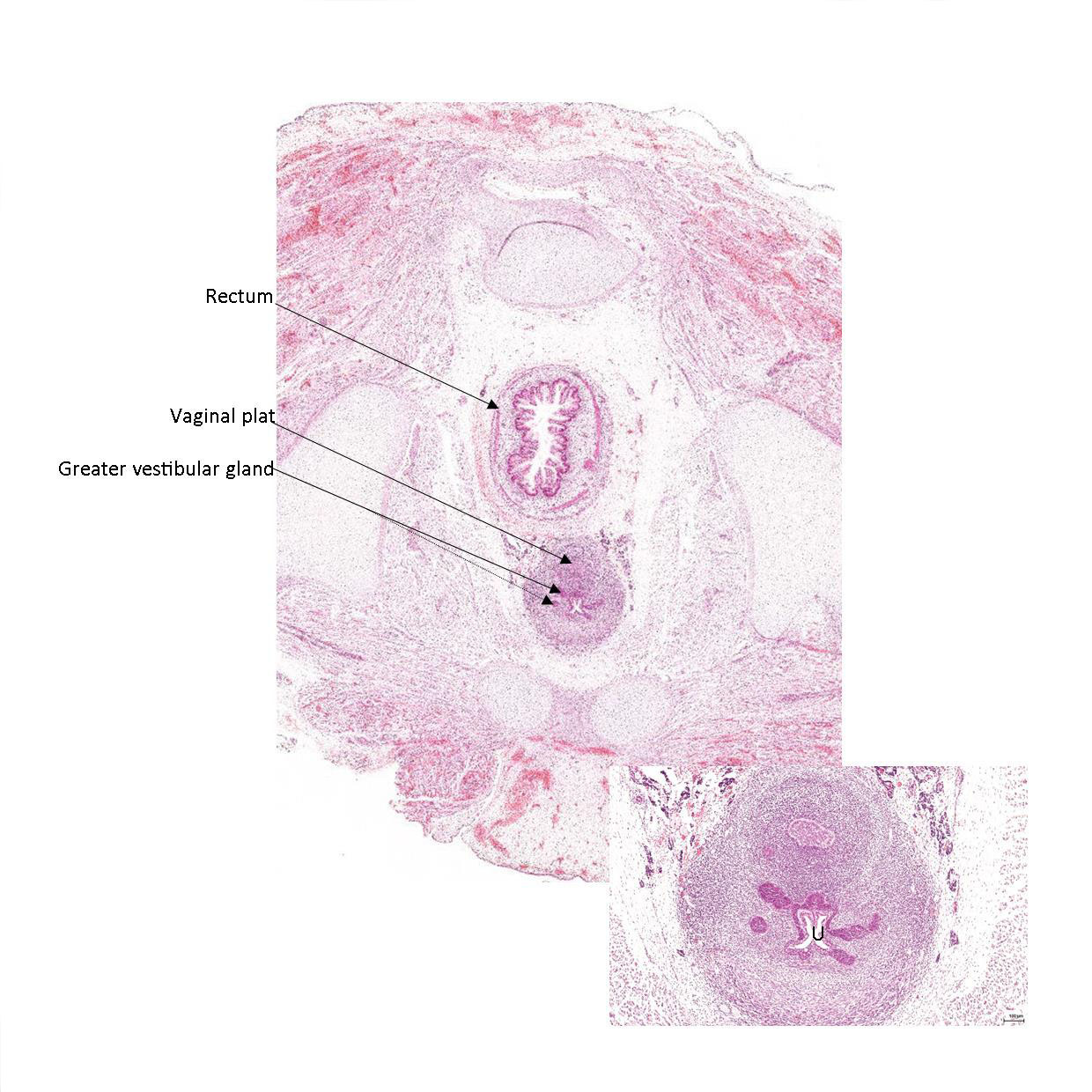 A histology section of a human fetus