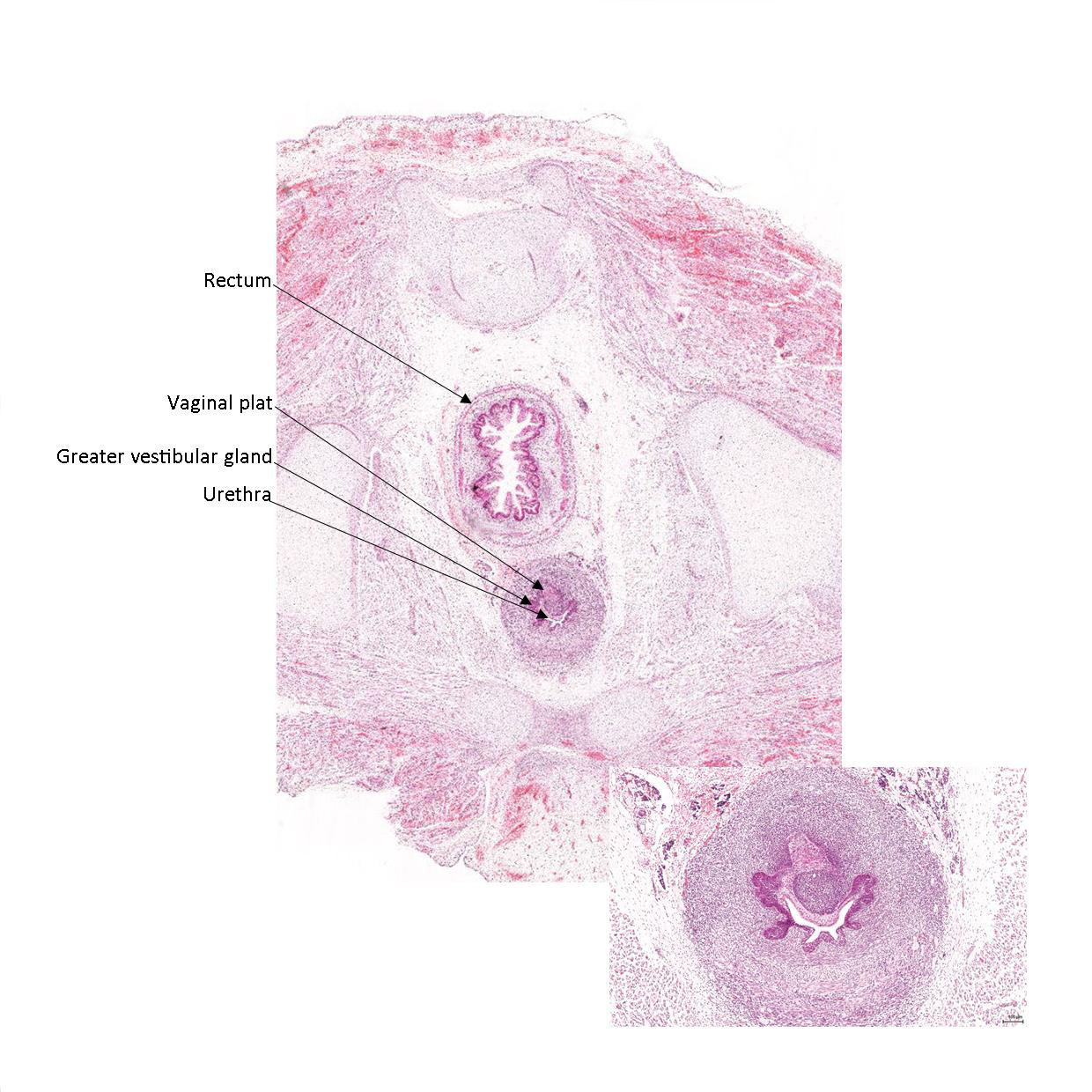 A histology section of a human fetus