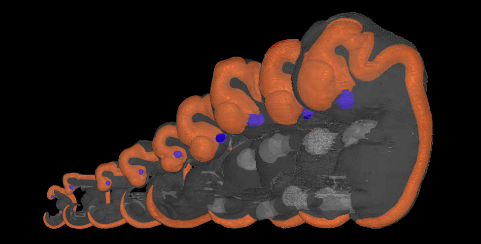 3D embryo models
